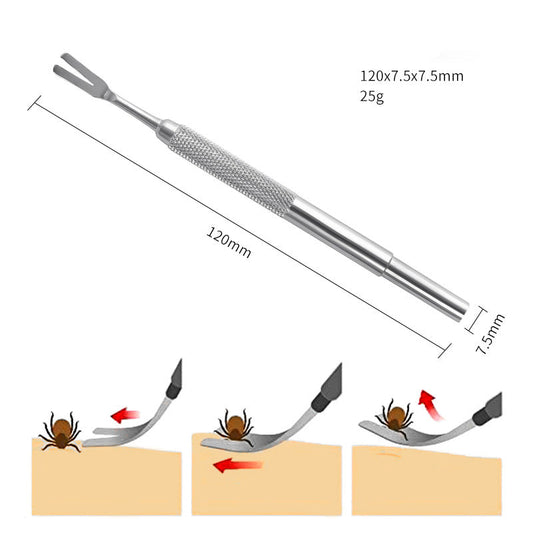 Stainless Steel Tick Removal Tweezers